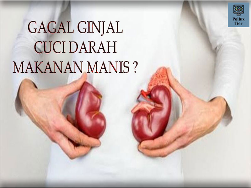 Gagal Ginjal Hingga Cuci Darah, Masih Konsumsi Makanan Manis