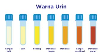 Waspada! Perubahan pada Urine Bisa Jadi Tanda Masalah Ginjal