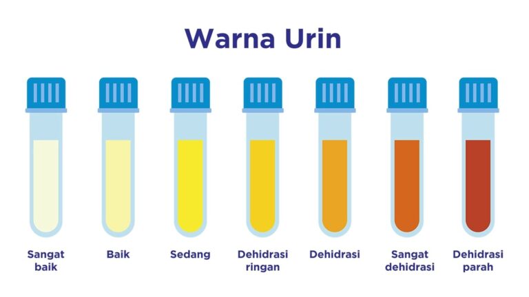 Waspada! Perubahan pada Urine Bisa Jadi Tanda Masalah Ginjal