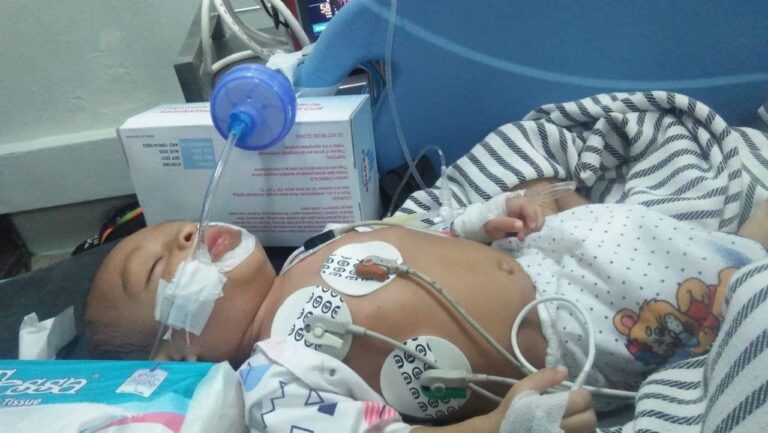 Bayi 2 Tahun Hampir Meninggal Akibat Sembelit, Paru-Paru Terhimpit