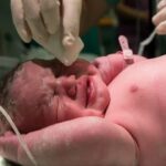 Persalinan Terencana Jadi Kunci: Harapan Baru untuk Bayi dengan Penyakit Jantung Bawaan