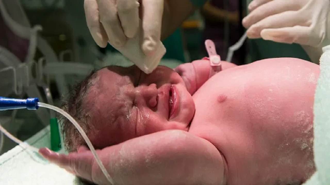 Persalinan Terencana Jadi Kunci: Harapan Baru untuk Bayi dengan Penyakit Jantung Bawaan