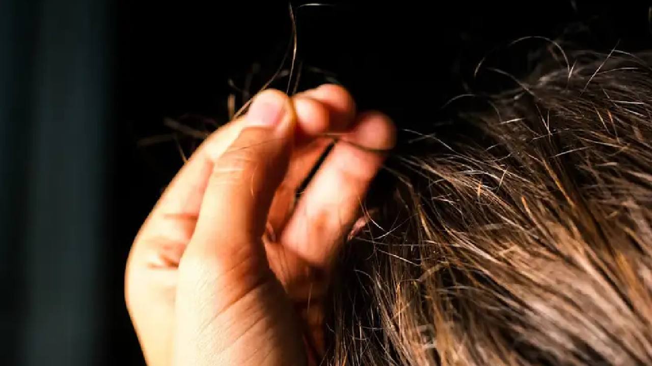 Waspada Rambut Mulai Menipis, Kenali Tanda Awalnya Sebelum Terlambat