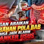 Perubahan Pola BAB Jangan Diabaikan, Kenali Alarm Kanker Usus