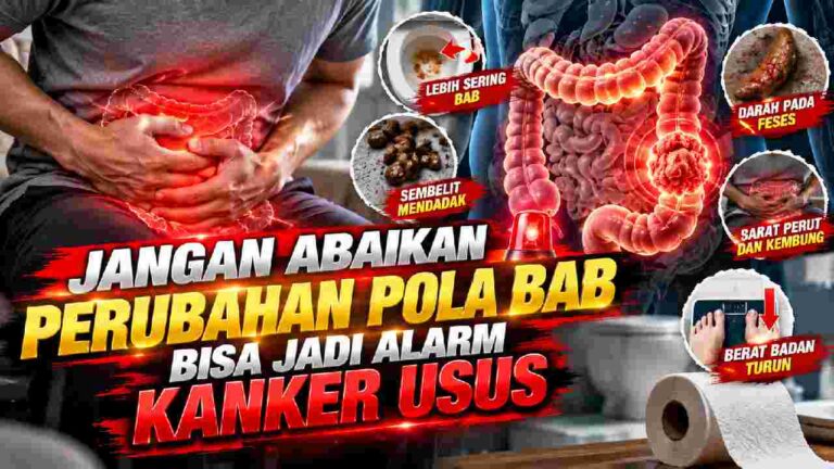 Perubahan Pola BAB Jangan Diabaikan, Kenali Alarm Kanker Usus
