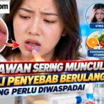 Sariawan Sering Muncul Kenali Penyebab Berulang yang Perlu Diwaspadai